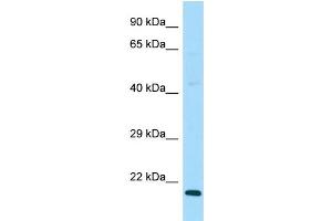 WB Suggested Anti-DAND5 Antibody Titration: 1. (DAND5 anticorps  (C-Term))