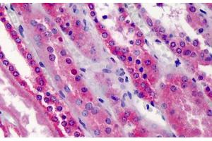 Human Kidney: Formalin-Fixed, Paraffin-Embedded (FFPE) (TRAF5 anticorps  (AA 77-186))
