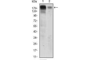 Western blot analysis using EGFR mouse mAb against A431 (1) AND Hela (2) cell lysate.