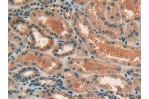 Detection of LIPG in Human Kidney Tissue using Polyclonal Antibody to Lipase, Endothelial (LIPG)