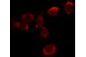 ABIN6278025 staining HepG2 by IF/ICC. (Hemoglobin Alpha 1 + 2 (HBA1,HBA2) (Internal Region) anticorps)