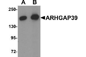Western blot analysis of ARHGAP39 in A20 cell lysate with ARHGAP39 antibody at (A) 1 and (B) 2 µg/mL (ARHGAP39 anticorps  (C-Term))