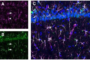 Expression of GFAP and TSH Receptor in rat hippocampus CA1 region. (GFAP anticorps  (Intracellular) (Atto 647N))