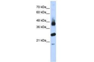 Image no. 1 for anti-F-Box and Leucine-Rich Repeat Protein 2 (FBXL2) (AA 71-120) antibody (ABIN6740795)