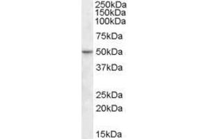 ABIN570968 (1µg/ml) staining of Human Ileum lysate (35µg protein in RIPA buffer). (TEAD2 anticorps  (Internal Region))