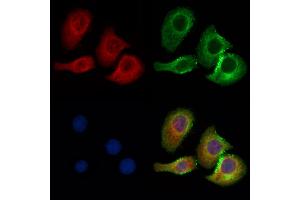 ABIN7094458 and ABIN7098506 staining Hela cells by IF/ICC.