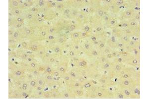 Immunohistochemistry of paraffin-embedded human liver tissue using ABIN7149254 at dilution of 1:100