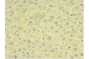 Immunohistochemistry of paraffin-embedded human liver tissue using ABIN7149254 at dilution of 1:100 (CYP2J2 anticorps  (AA 328-502))