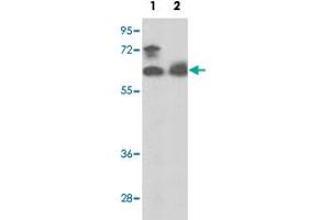 Western blot analysis of PANK1 polyclonal antibody  in MCF-7 cell line (Lane 1) and mouse spleen tissue lysates (Lane 2)(35 ug/lane). (PANK1 anticorps  (N-Term))