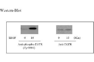 Image no. 5 for Epidermal Growth Factor Receptor (EGFR) ELISA Kit (ABIN625224) (EGFR Kit ELISA)