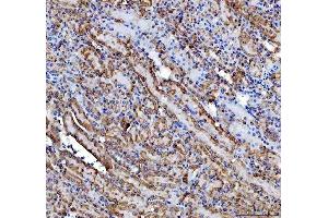 IHC analysis of IMPDH2 using anti-IMPDH2 antibody (ABIN7603063).