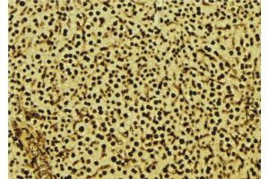 ABIN6277605 at 1/100 staining Mouse liver tissue by IHC-P.