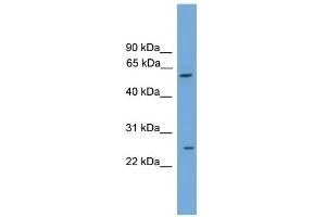 WB Suggested Anti-POT1 Antibody Titration: 0. (POT1 anticorps  (Middle Region))