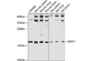 Western blot analysis of extracts of various cell lines, using RPLP1 antibody (ABIN6129657, ABIN6147166, ABIN6147167 and ABIN6222445) at 1:1000 dilution. (RPLP1 anticorps  (AA 1-114))