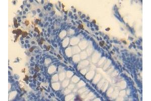 Detection of OTC in Human Rectum Tissue using Polyclonal Antibody to Ornithine Transcarbamylase (OTC)