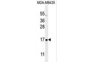 CU002 Antibody (C-term) western blot analysis in MDA-MB435 cell line lysates (35µg/lane).