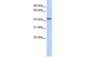 CCR2 antibody used at 1 ug/ml to detect target protein. (CCR2 anticorps)