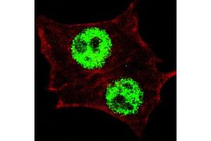 Fluorescent confocal image of HeLa cells stained with (ABIN390035 and ABIN2839785) Phospho-KLF4- antibody. (KLF4 anticorps  (pSer254))