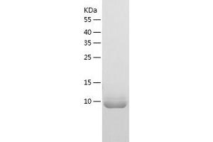 Western Blotting (WB) image for Transformer 2 beta Homolog (TRA2B) (AA 120-199) protein (His tag) (ABIN7125454)