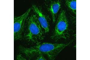 anti-Plectin (PLEC) (AA 2644-2671), (Middle Region) antibody