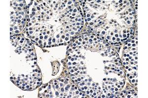 ABIN7097028 and ABIN7101095 at 1/100 staining mouse testis tissue by IHC-P.
