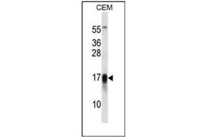 Western blot analysis of Dysadherin / FXYD5 Antibody (Center) in CEM cell line lysates (35ug/lane). (FXYD5 anticorps  (Middle Region))