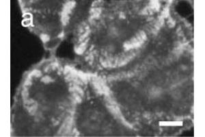 Immunocytochemistry image of Collagen XVII staining in cultured human Skin squamous carcinoma DJM-1 cells.