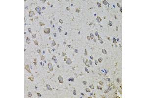 Immunohistochemistry of paraffin-embedded mouse brain using ARHGEF3 antibody. (ARHGEF3 anticorps)