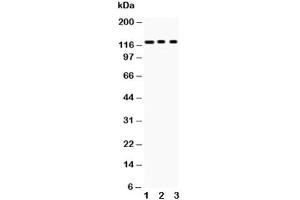 Western blot testing of PLD1 antibody and Lane 1:  mouse heart (PLD1 anticorps  (AA 1-330))