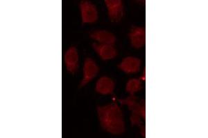 ABIN6267027 staining Hela by IF/ICC. (MAPKAP Kinase 5 anticorps  (Internal Region))
