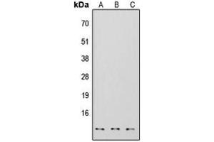Western blot analysis of S100-A7 expression in HEK293T (A), NS-1 (B), H9C2 (C) whole cell lysates. (S100A7 anticorps  (Center))