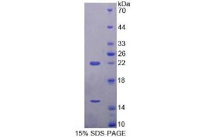 SDS-PAGE (SDS) image for Endothelin Converting Enzyme 2 (ECE2) (AA 1-163) protein (His tag) (ABIN4990414)