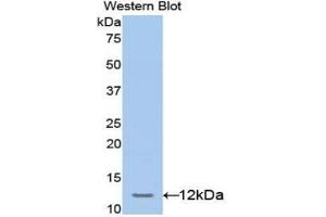 Western blot analysis of the recombinant protein. (TCF20 anticorps  (AA 125-213))