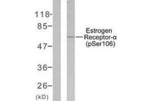 Western blot analysis of extracts from MCF7 cells, using Estrogen Receptor-alpha (Phospho-Ser106) Antibody. (Estrogen Receptor alpha anticorps  (pSer106))