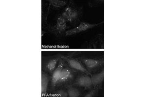Immunofluorescence staining of SQSTM1 polyclonal antibody  on Methanol-fixed and PFA fixed HeLa cells.