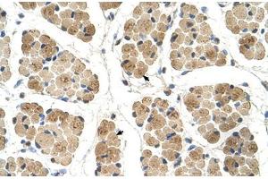 Immunohistochemical staining (Formalin-fixed paraffin-embedded sections) of human muscle with KLHL31 polyclonal antibody . (KLHL31 anticorps  (AA 501-550))