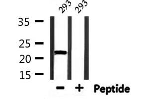 Western blot analysis of extracts from 293, using TEAD1 Antibody.