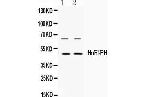 Western blot analysis of HnRNP H expression in HELA whole cell lysates ( Lane 1) and HEPG2 whole cell lysates ( Lane 2). (HNRNPH1 anticorps  (N-Term))
