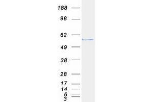 Validation with Western Blot