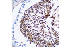 Immunohistochemistry of paraffin-embedded rat testis using SP Rabbit pAb (ABIN3022967, ABIN3022968, ABIN1513554 and ABIN6219322) at dilution of 1:100 (40x lens).