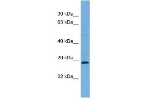 Western Blotting (WB) image for anti-Mediator Complex Subunit 19 (MED19) (Middle Region) antibody (ABIN2786282) (MED19 anticorps  (Middle Region))