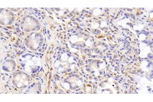 Detection of ACVA in Human Small intestine Tissue using Polyclonal Antibody to Activin A (ACVA)