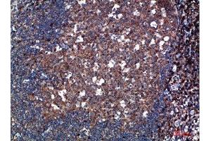 Immunohistochemical analysis of paraffin-embedded human-tonsil, antibody was diluted at 1:200