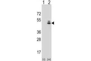 Western Blotting (WB) image for anti-Actin, gamma 1 (ACTG1) antibody (ABIN3002670) (Actin, gamma 1 anticorps)