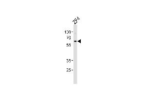 Western blot analysis of lysate from ZF4 cell line, using (DANRE) camk2d2 Antibody (ABIN657721 and ABIN2846708).
