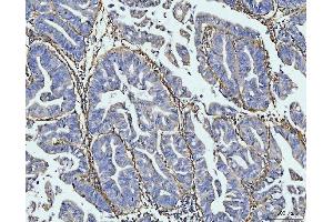 IHC analysis of COL6A1 using anti-COL6A1 antibody (ABIN7600515).