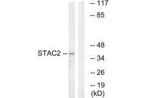 Western blot analysis of extracts from K562 cells, using STAC2 antibody.