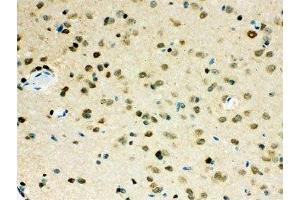 IHC-P testing of VCP antibody and mouse brain tissue (VCP anticorps  (AA 732-760))