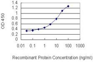 Detection limit for recombinant GST tagged RCSD1 is 0. (RCSD1 anticorps  (AA 181-289))