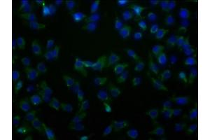 Immunofluorescence staining of HepG2 cells with ABIN7170175 at 1:100, counter-stained with DAPI.